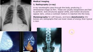 X-rays, MRIs and other medical imaging methods screenshot 3