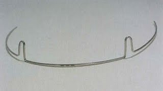 In block extrusion bend : tratment of open bite video 1