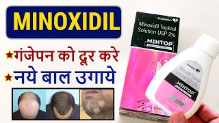 Mintop Hair Lotion 2% Minoxidil For Hair Loss गजपन क दर करन क लए कस इसतमल कर