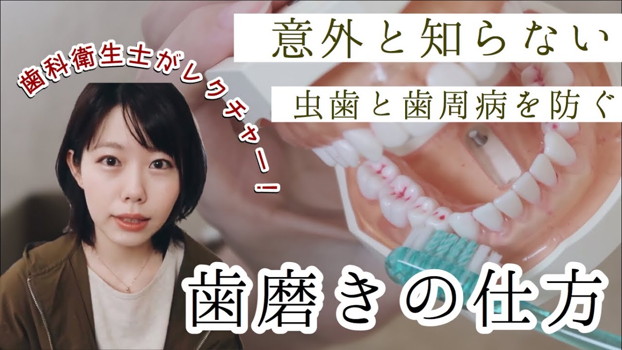 【歯科衛生士が教える】虫歯と歯周病予防の歯磨きについて