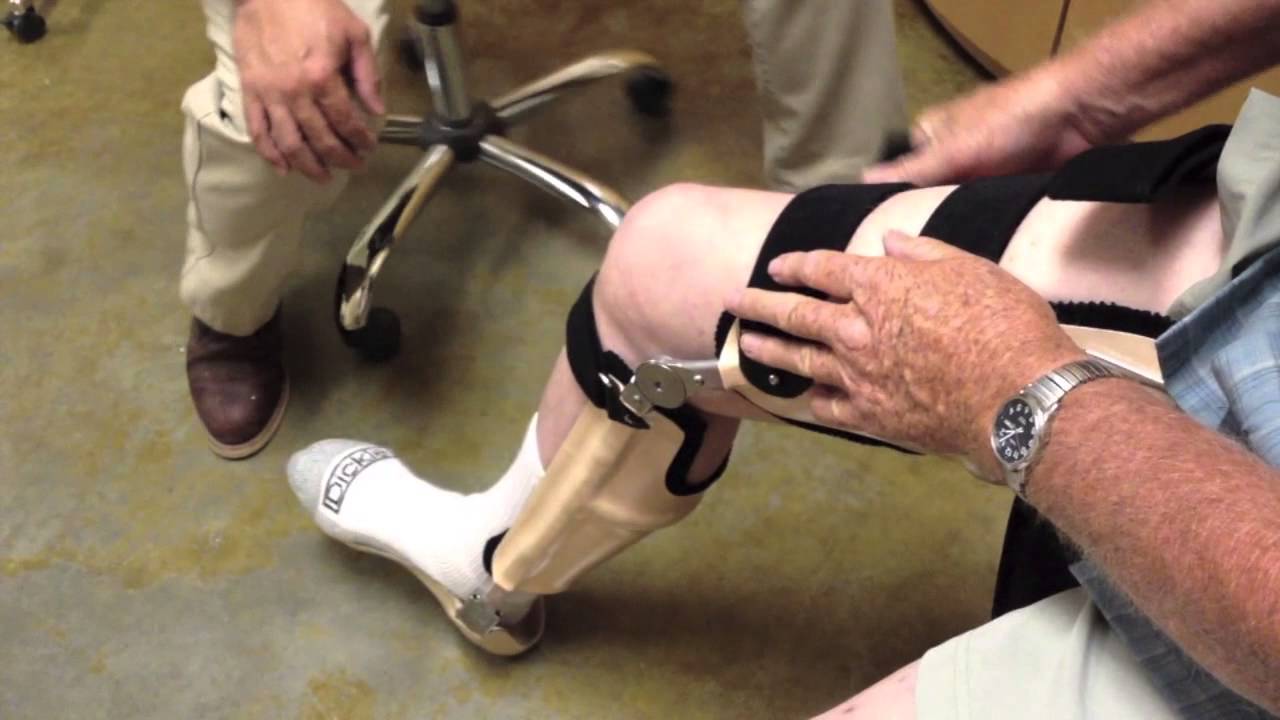 orthotists and prosthetists