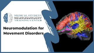 Neuromodulation for Movement Disorders