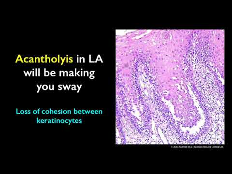Video: Pemphigus - Behandeling En Preventie Van De Ziekte