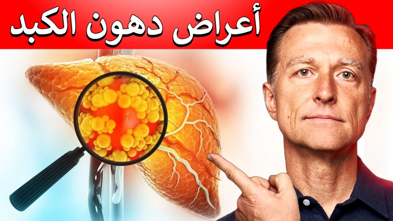 أعراض تخبركم بوجود دهون في الكبد لم أكن أعلم عنها وما هي أفضل طريقة للتخلص منها