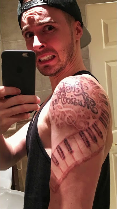 Laser Tattoo Removal Experience in London (Part 1)
