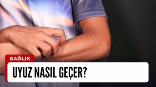 Uyuz Nasıl Geçer?