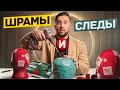 ШРАМЫ ПОСЛЕ ПЕРЕСАДКИ ВОЛОС
