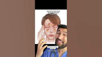 “My Nose is Always Blocked” #help.