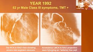 PCI in Anomalous Coronary Arteries: Challenges & Learning Experience | Prof. (Dr.) Ashok Seth
