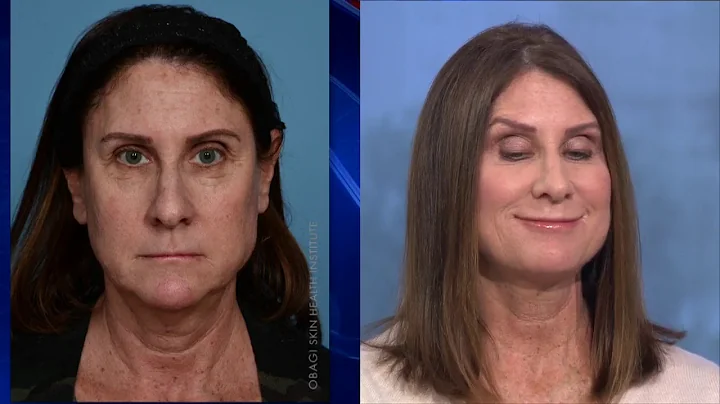 50 and fabulous: Dermatologist shares steps to kee...