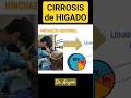 PELIGRO! ¿Qué es la Cirrosis? #doctor #consejos #ciencia #salud #dr