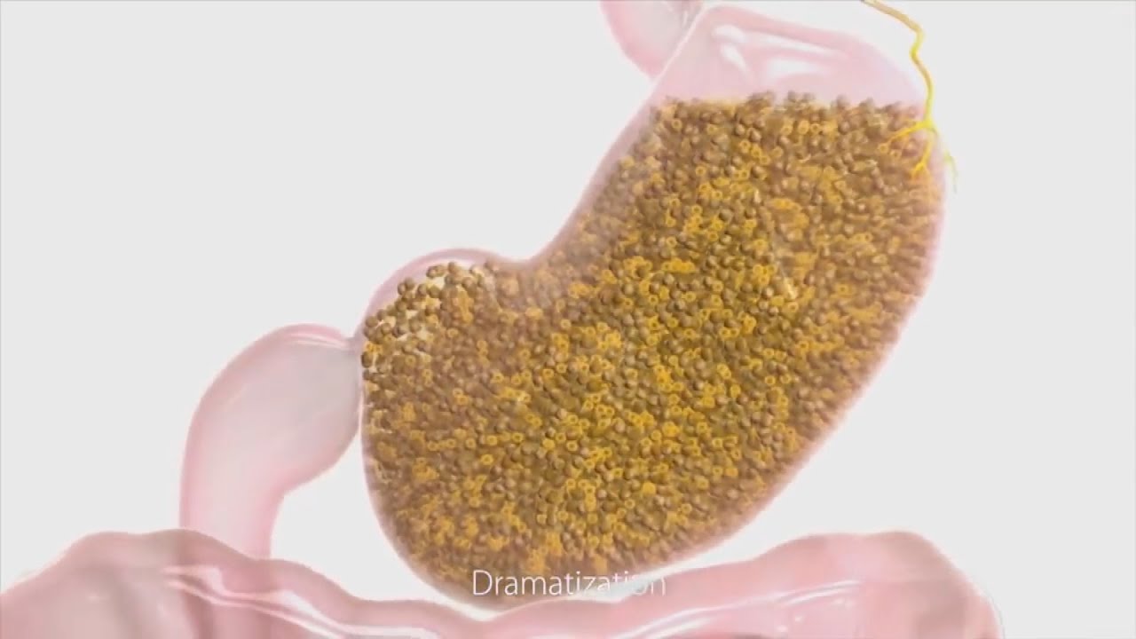 Adding A Commercial Gym At Hotels As Well As Resorts