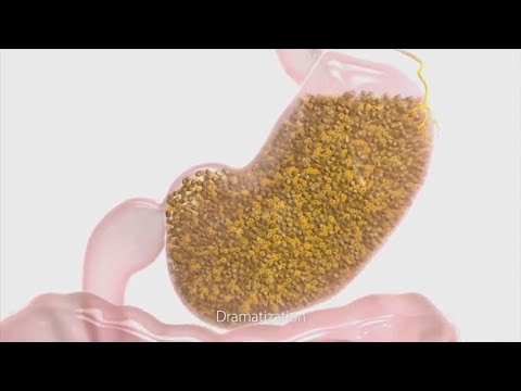 Video: Obesity pill invented