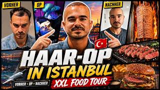 Meine HAARTRANSPLANTATION in Istanbul 🇹🇷  + XXL FOOD TOUR 🥙