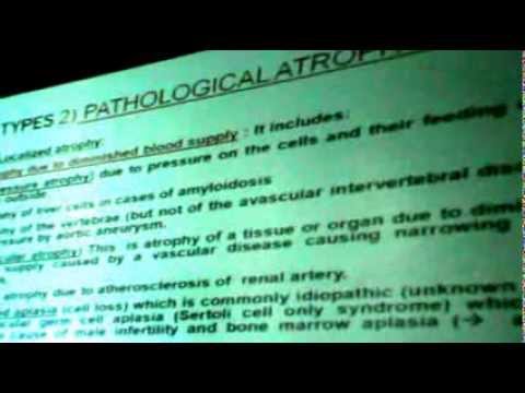 video phone beyonce mp3 Dr.Sahar - Growth Disturbances 1 - Pathology