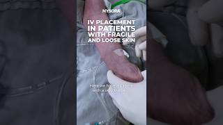IV Placement: Fragile and Loose Skin #intravenous