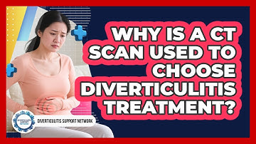 Why Is A CT Scan Used To Choose Diverticulitis Treatment? - Diverticulitis Support Network