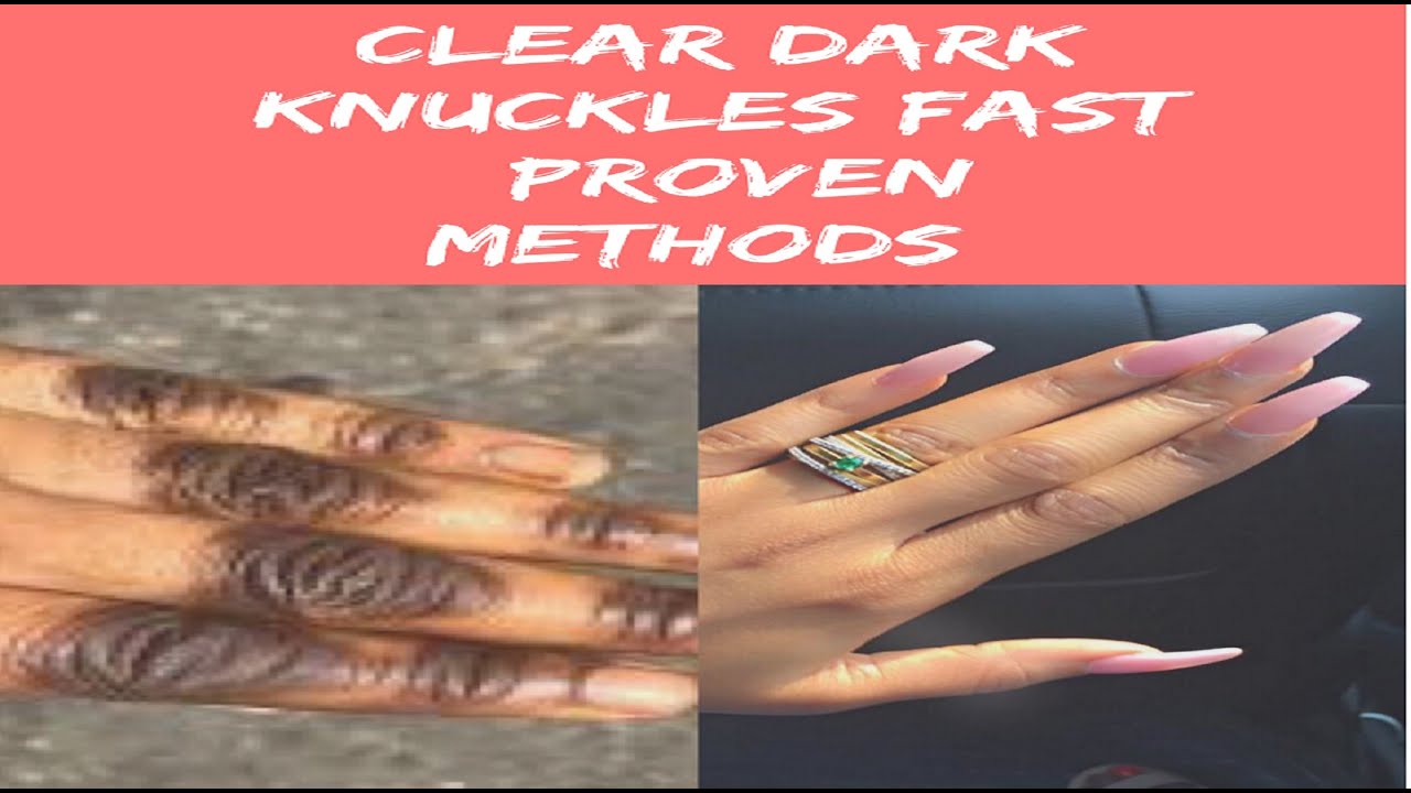 CLEAR DARK KNUCKLES FAST PROVEN METHOD USING INGREDIENTS AT HOME