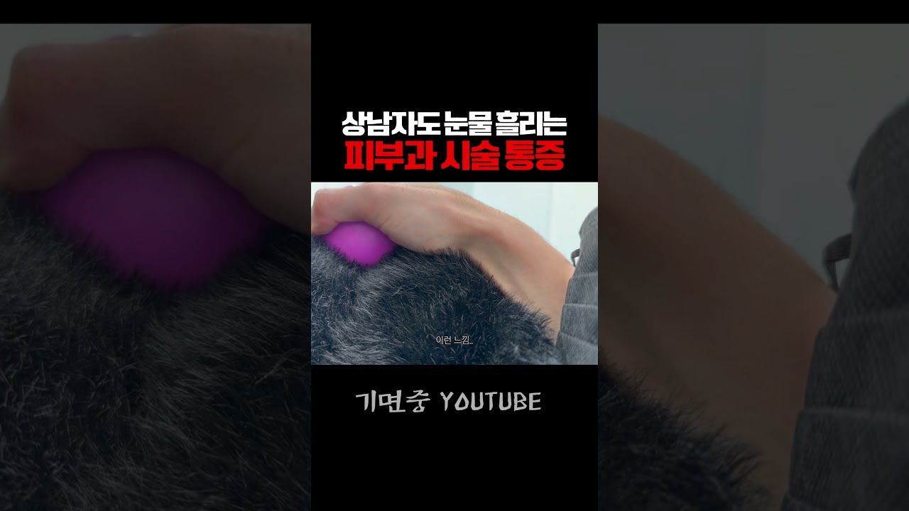 통증 리얼 리뷰 (ft. 수면마취 안 한 이유) [🔼]
