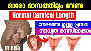 Cervical Length During Pregnancy Malayalam|Short Cervix|Cervical Dilation screenshot 5