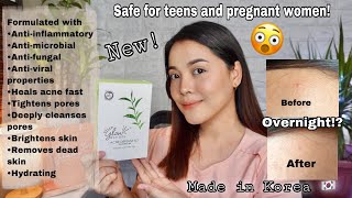 hello glow acne defense set