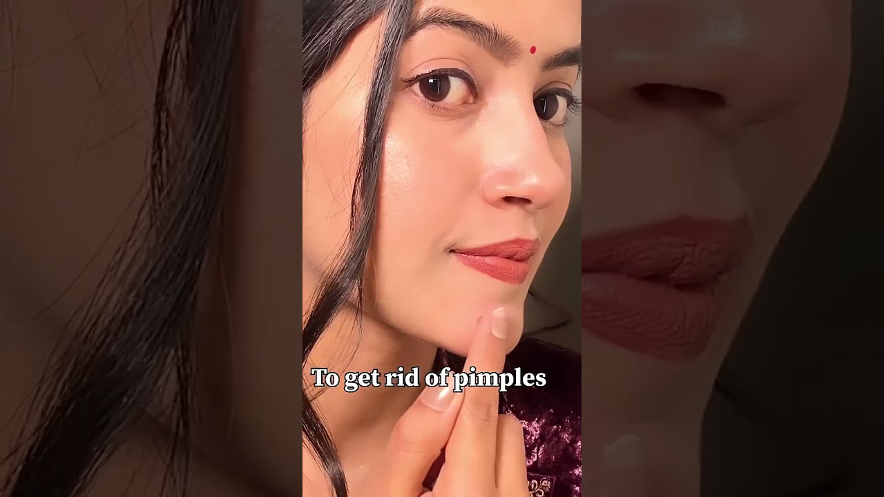 Use this cream to get acne-free skin.  It’s Sebogel from 