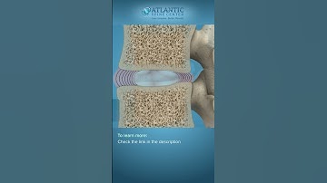 Spine Anatomy | Know Your Spine #Shorts