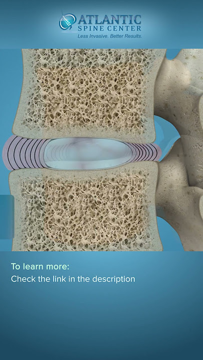Spine Anatomy | Know Your Spine #Shorts