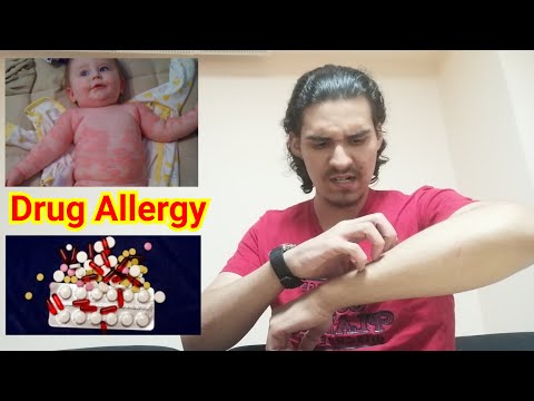 الحساسية من الأدوية - أسبابها وأعراضها وتشخيصها وطرق علاجها / Drug Allergy