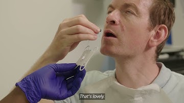 Cytosponge video, the ‘Sponge on a String’ Test, to help detect Barrett’s oesophagus (for patients)