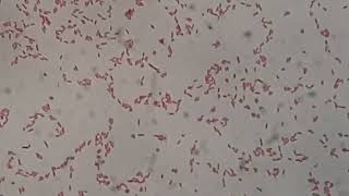Gram Negative Rods of Citrobacter farmeri in Gram Staining of Culture Microscopy at various mag. Gram Negative Rods Under The Microscope At Various Magnification