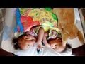 Conjoined Twins: Maria and Teresa