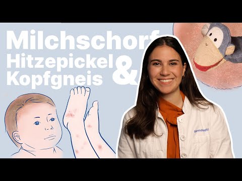 Video: Bekommen Kleinkinder Milchschorf?