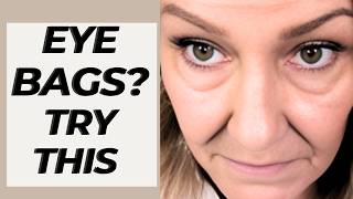 Dark Circles, Bags & Puffiness After 50: What Actually Works