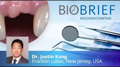 Horizontal Ridge Augmentation in the Esthetic Zone