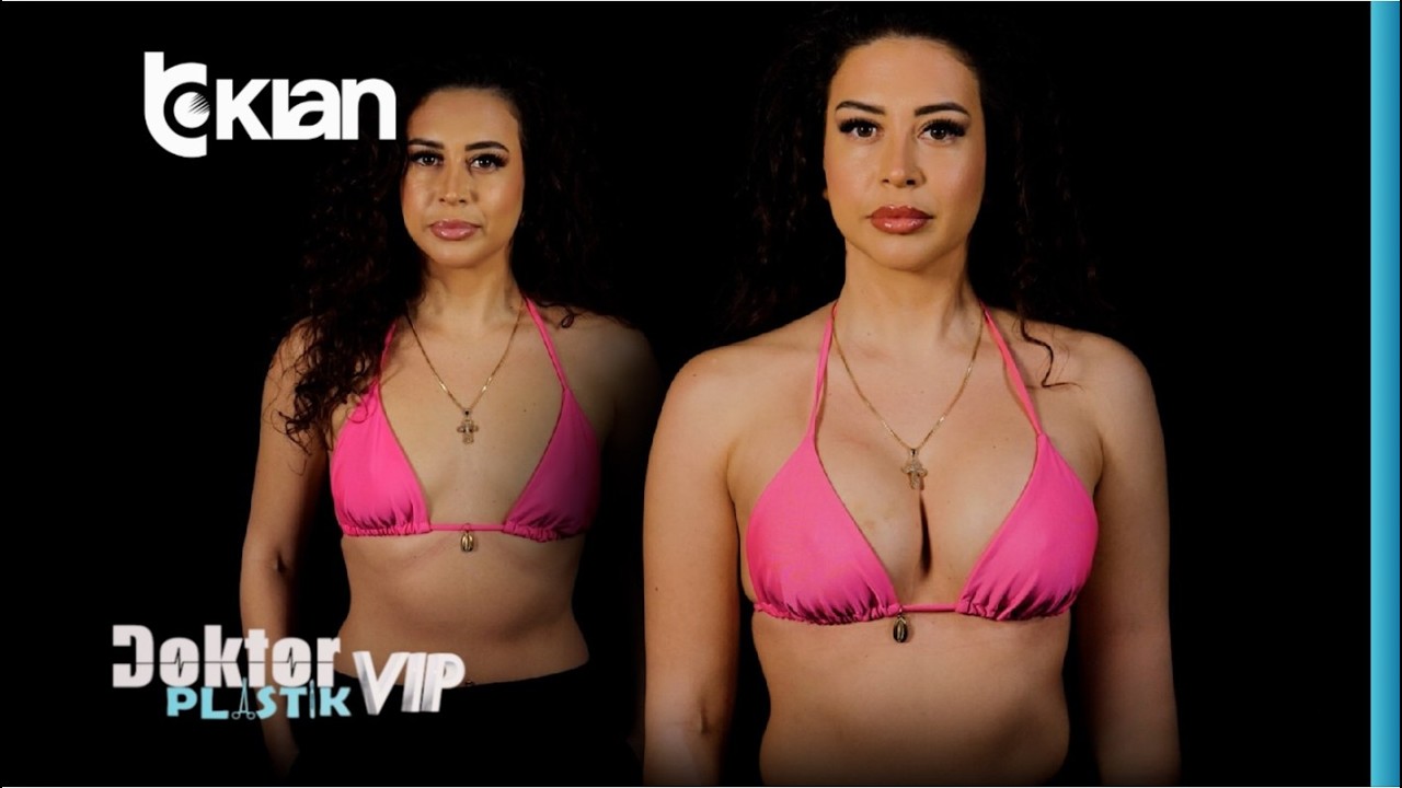 Nje seks bombë! Ja si duket Vivien Thano pas zmadhimit te gjoksit |Doktor Plastik VIP 21 Shkurt 2026