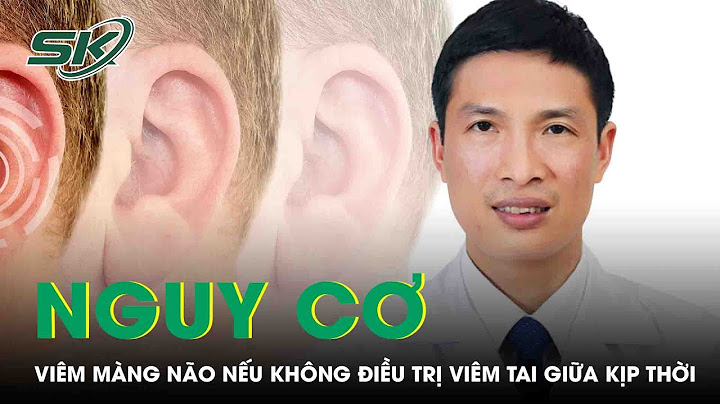 Viêm tai giữa cấp là gì