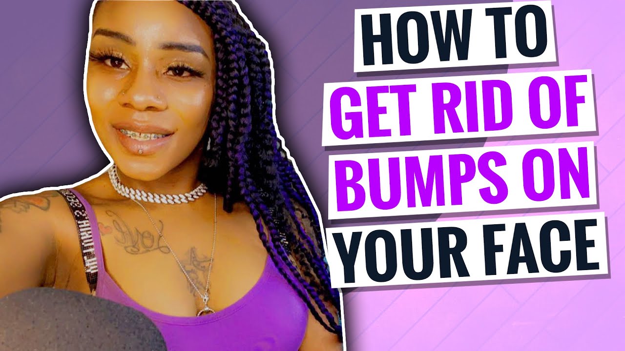 How To Get Rid Of Bumps On Your Face YouTube how-to-get-rid-of-bumps-on-your-face-youtube