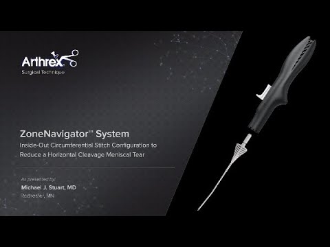 orthopedic disability ZoneNavigator™ System Inside-Out Circumferential Stitch Configuration to Reduce a Horizontal Cleavag