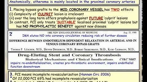David Taggart. CABG and stents in 2014