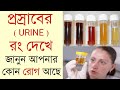 এই লক্ষণ দেখলে বুঝে যাবেন আপনার কিডনির সাহায্য দরকার | What Your Urine Colour Says About Your Health