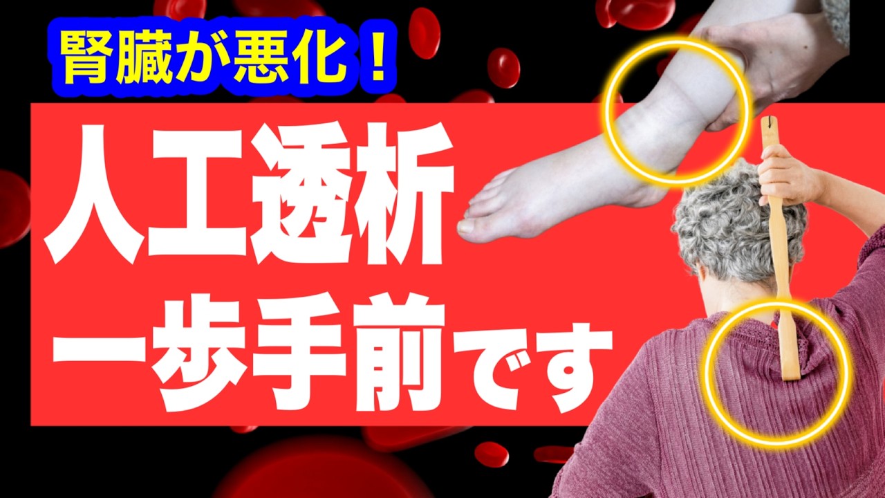 【腎臓が悪化】人工透析寸前のサインや症状と腎臓病の予防法
