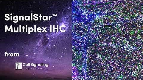 Spatial Biology Has a New Star: SignalStar Multiplex IHC | Cell Signaling Technology