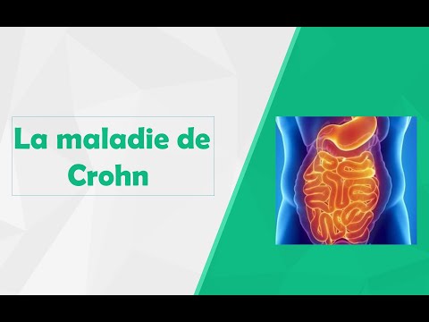 Vidéo: Maladie De Crohn: Faits, Statistiques Et Vous