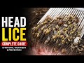 Viral! Cara Mengatasi Kutu Rambut Di Kepala Dengan Cepat & Aman