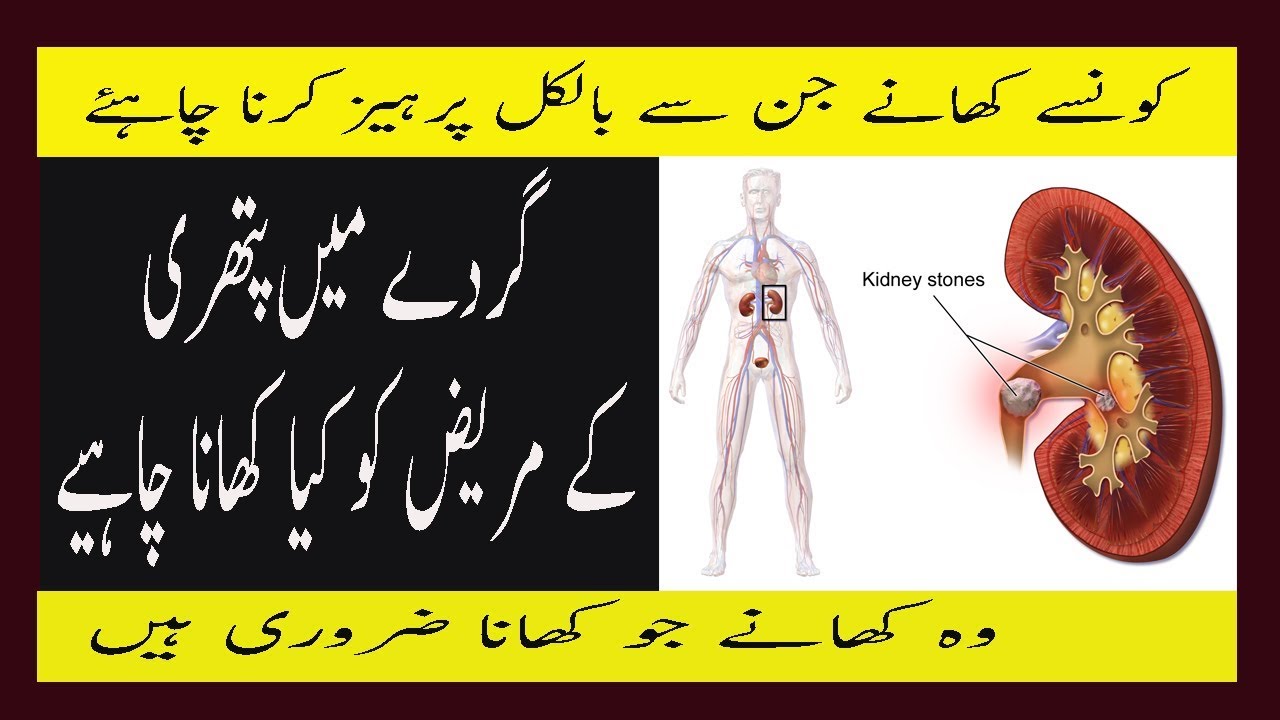Kidney Stone Diet Chart In Urdu