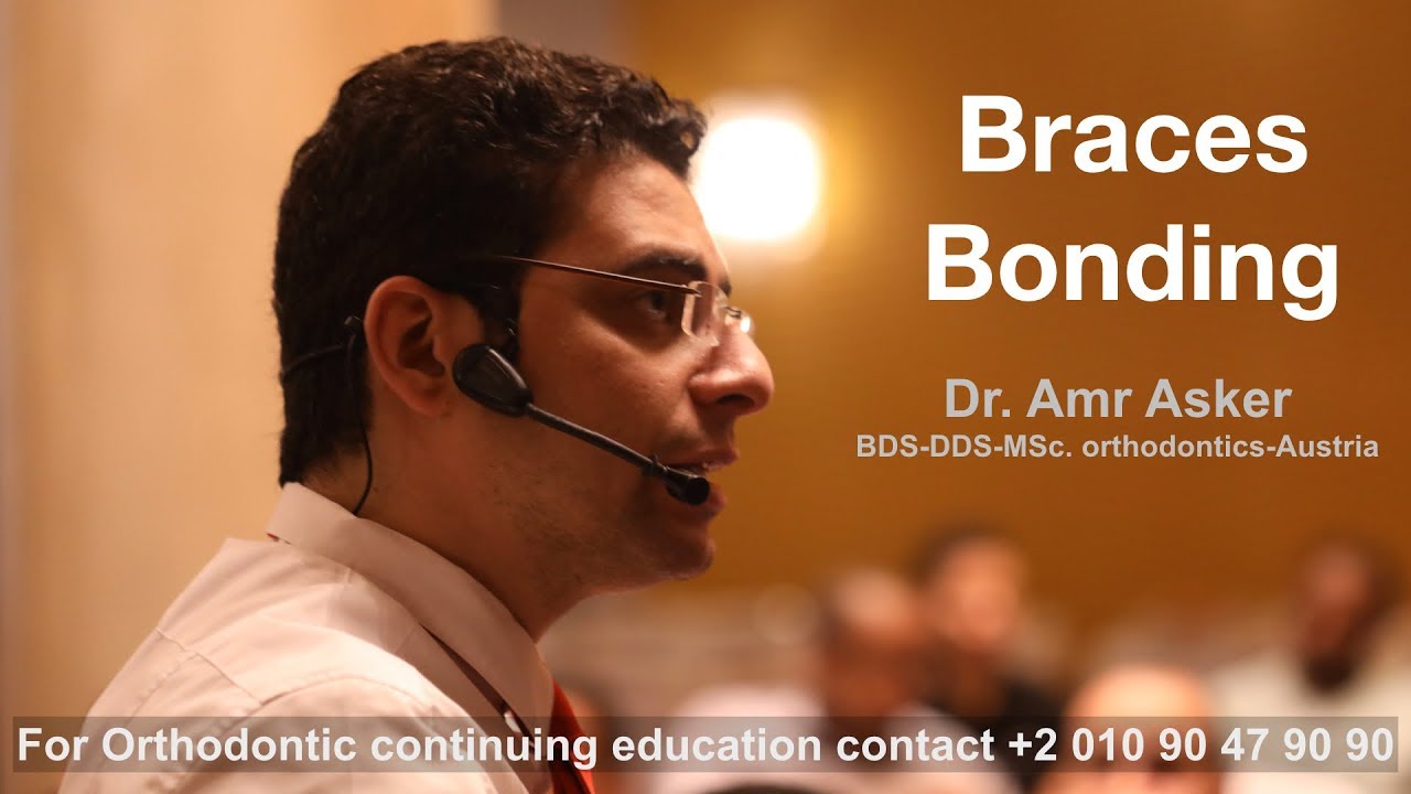 Braces bonding in orthodontics by dr. Amr Asker Egypt
