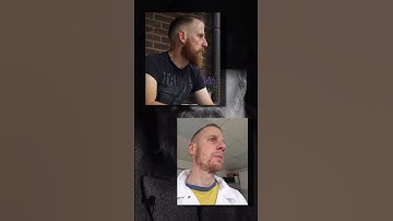 Do You have A Patchy Beard #shorts