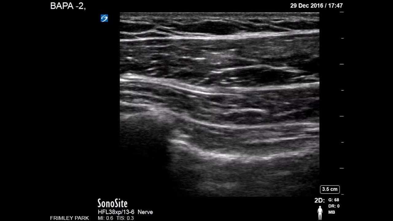 pectoral muscles scanning youtube pectoral region