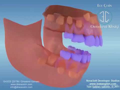 Video: Önce Hangi Dişler Kesilir
